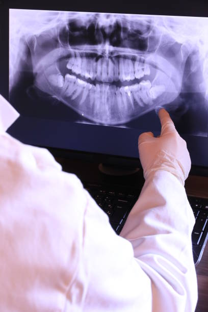 Best Emergency Dentist for Knocked-Out Tooth in Fruit Cove, FL