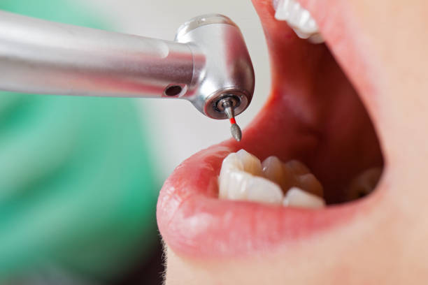 Best Emergency Dental Services for Seniors in Fruit Cove, FL